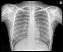 X rays Service