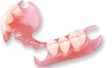 Removable Dentures Service