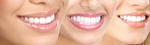 Jaw Surgeries Service