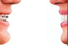 Orthodontics Dental Treatment Services